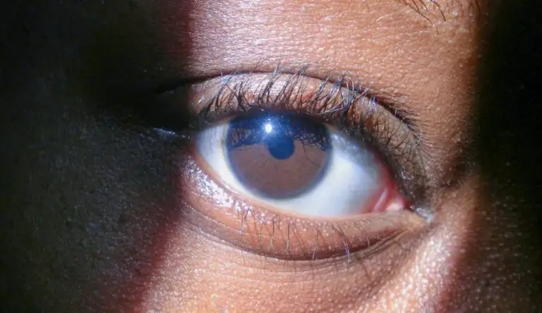 Blue Ring Around Eyes Spiritual Meaning: Understanding Its Significance