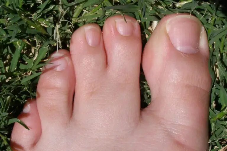 Webbed Toes Spiritual Meaning: Understanding the Symbolism Behind This Physical Trait