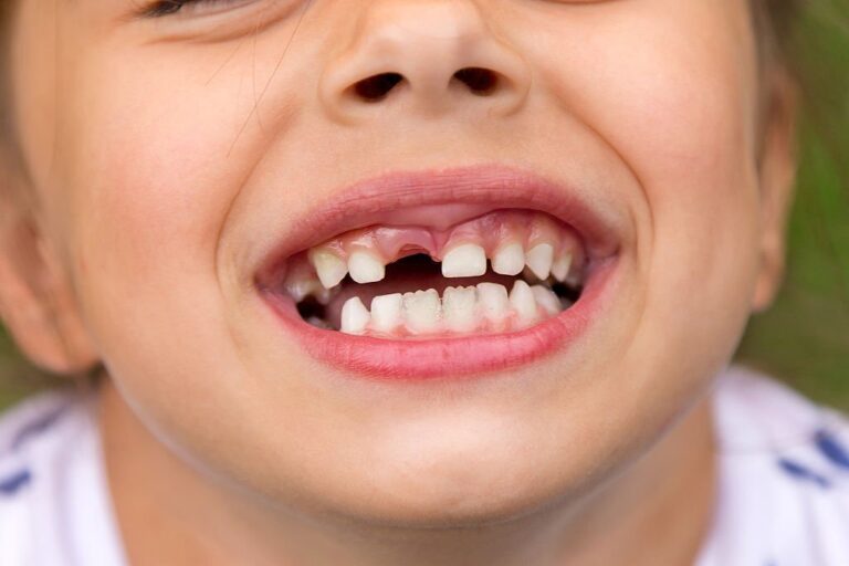 Little girl fell a baby tooth. Child's mouth with hole between the teeth. Shallow dept of field